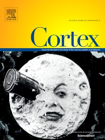 Parallel word reading revealed by fixation-related brain potentials